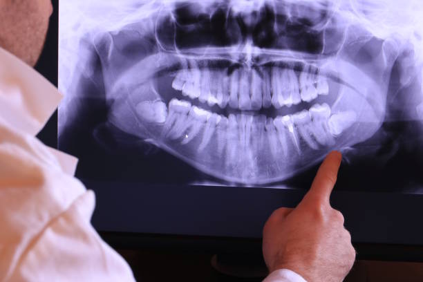 Best Emergency Broken Tooth Repair in East Tawas, MI